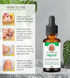 Onychomycosis Repair Bacteriostatic Liquid designed to treat fungal nail infections